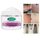 Scar Removal Cream - Addy Mart